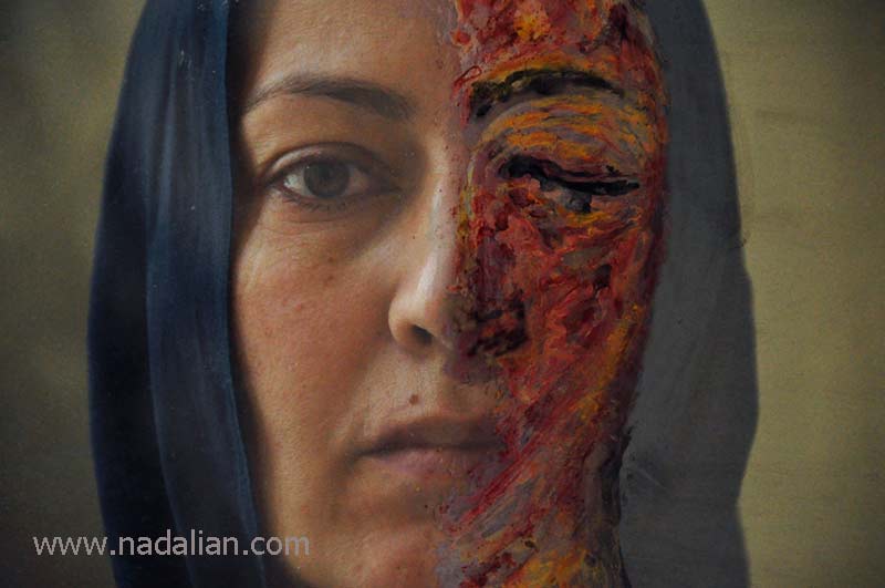 Victims of acid attack: Ahmed Nadalian's artwork, 2014